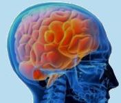 neurologo